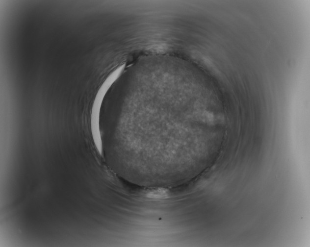 X0000088850576200707061035