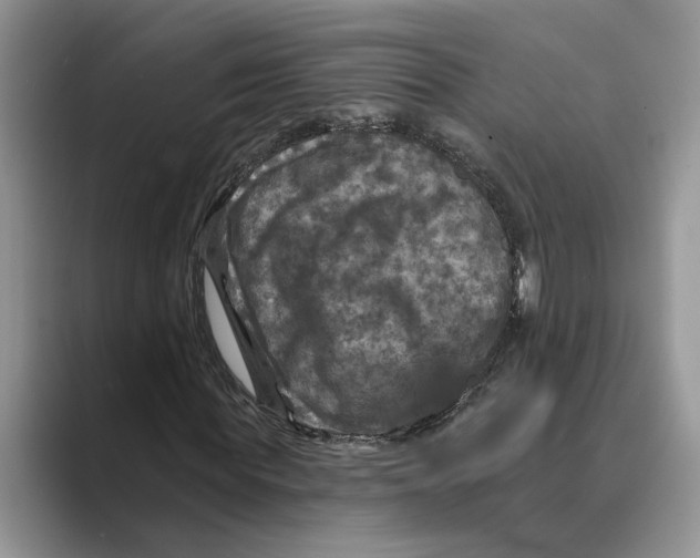 X0000088850819200707061031