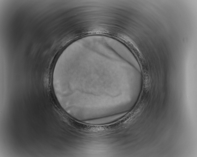 X0000088850882200707061031