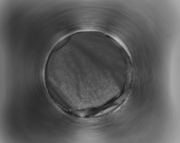 X0000088851197200707061027