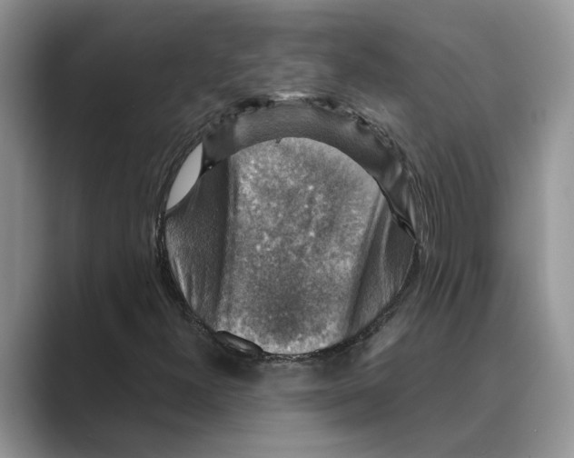 X0000088851300200707061025