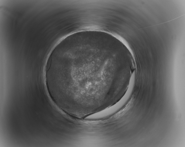 X0000088851389200707061025