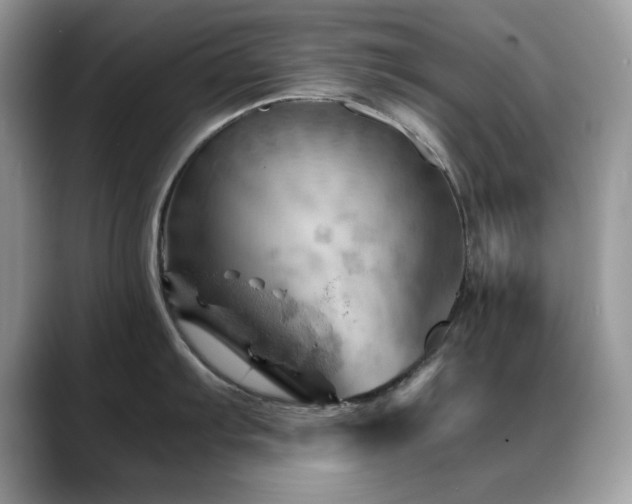 X0000088861103200706081148