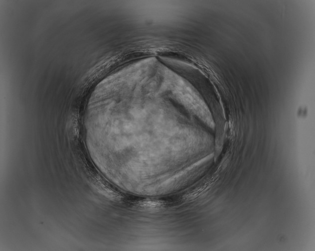 X0000088860313200706291523