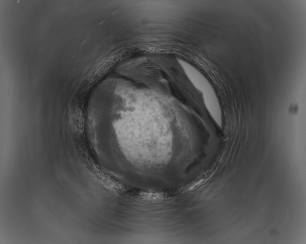 X0000088860469200706291522