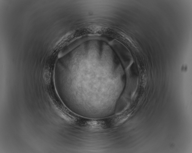 X0000088860558200706291520