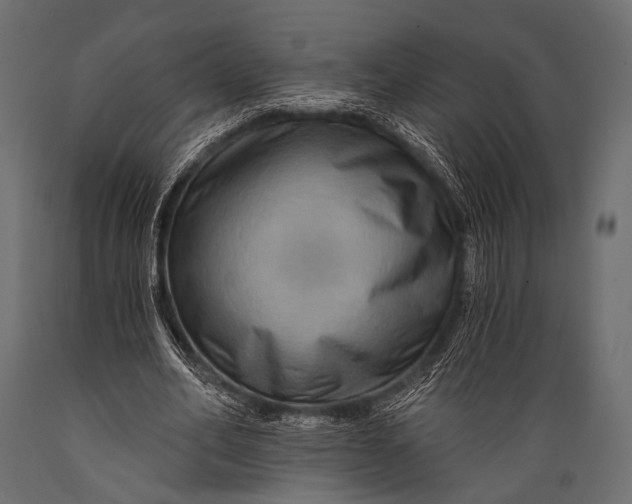 X0000088860582200706291520