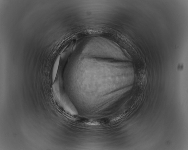 X0000088860604200706291519