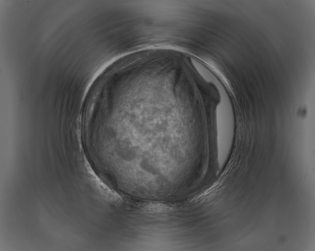 X0000088861100200706291512