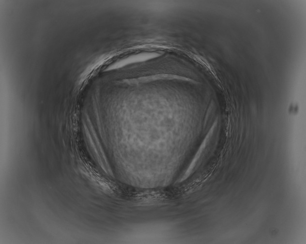 X0000088861159200706291511