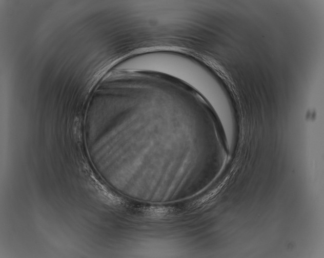 X0000088861177200706291511