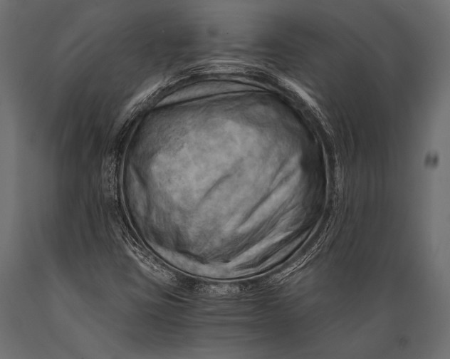 X0000088861403200706291507