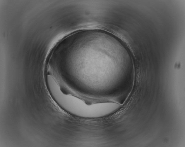 X0000088861472200706291507