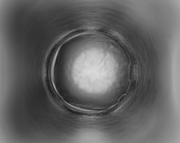 X0000088860726200707061050