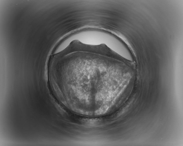 X0000088860791200707061050