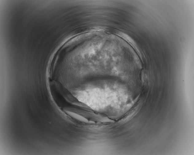 X0000088860859200707061049