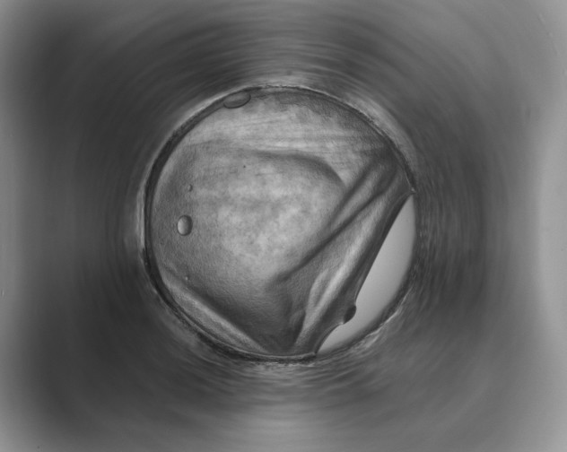 X0000088861036200707061047