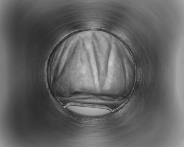 X0000088861039200707061047