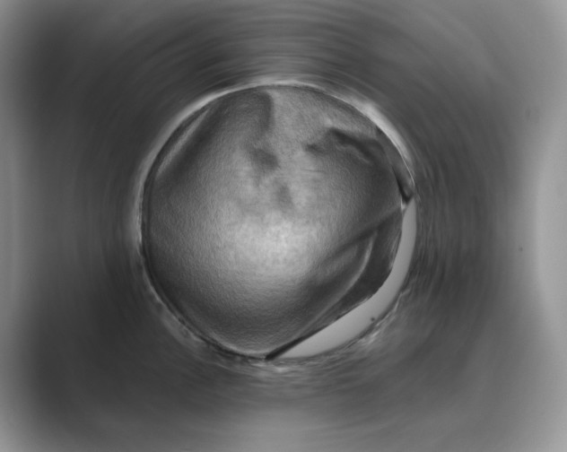 X0000088861148200707061046