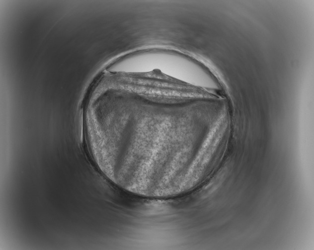 X0000088861175200707061045