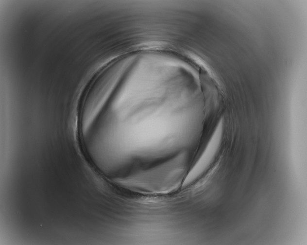 X0000088861418200707061043