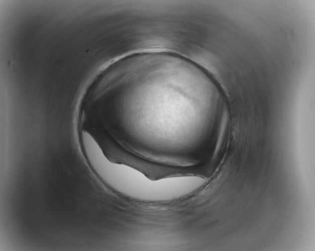 X0000088861472200707061042