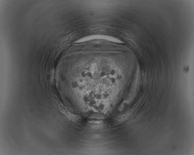 X0000088870189200706291549