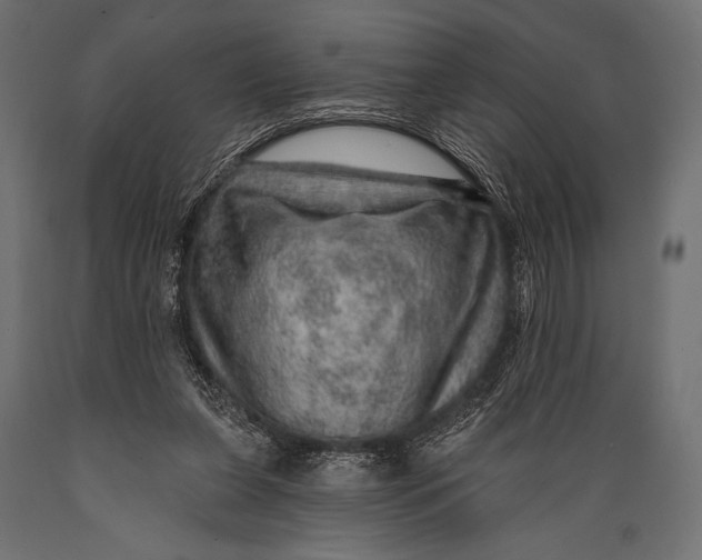 X0000088870255200706291547
