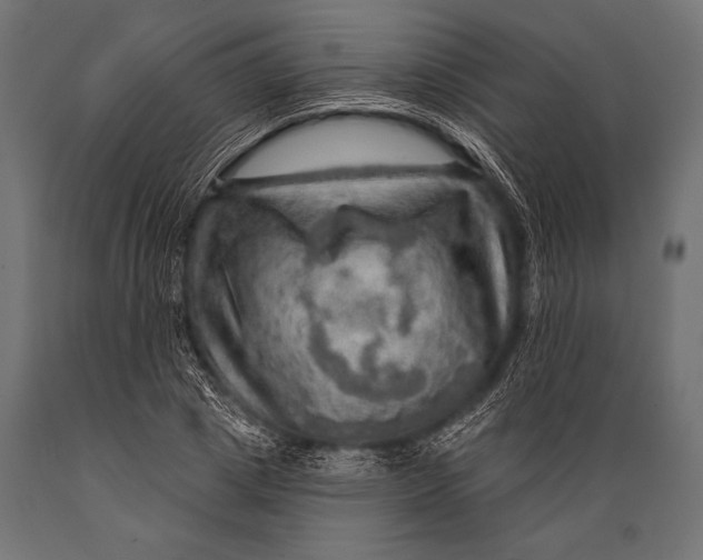 X0000088870833200706291538
