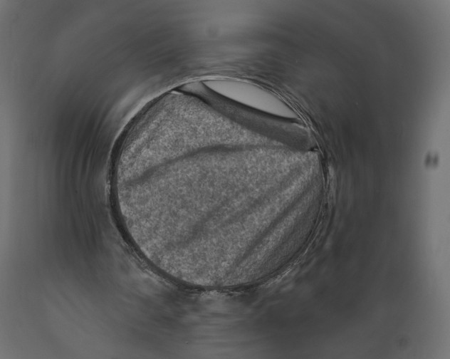 X0000088870290200707061353