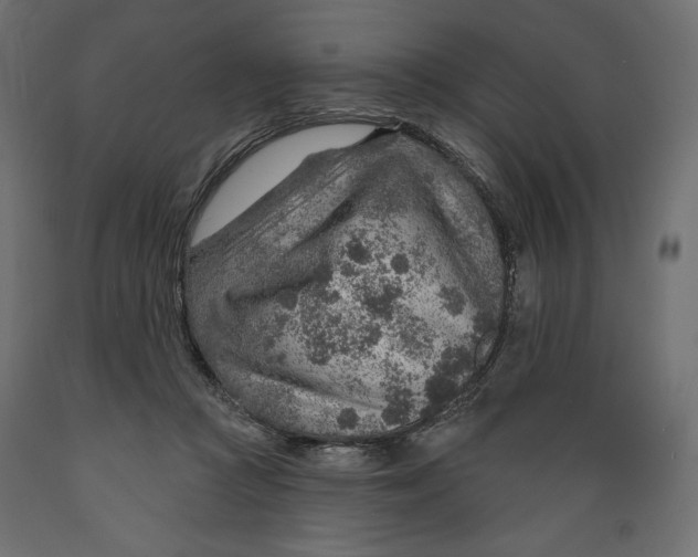 X0000088870361200707061352