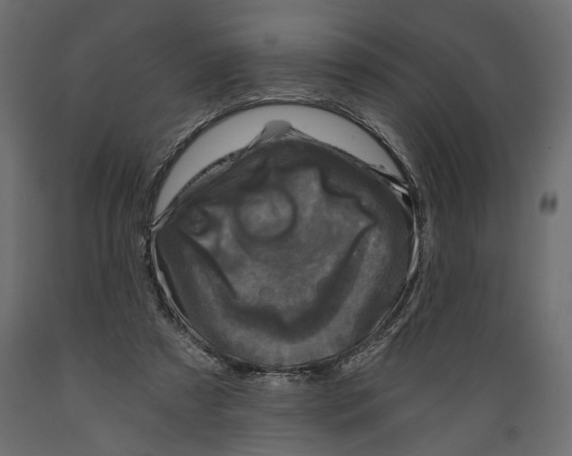X0000088890305200707061438