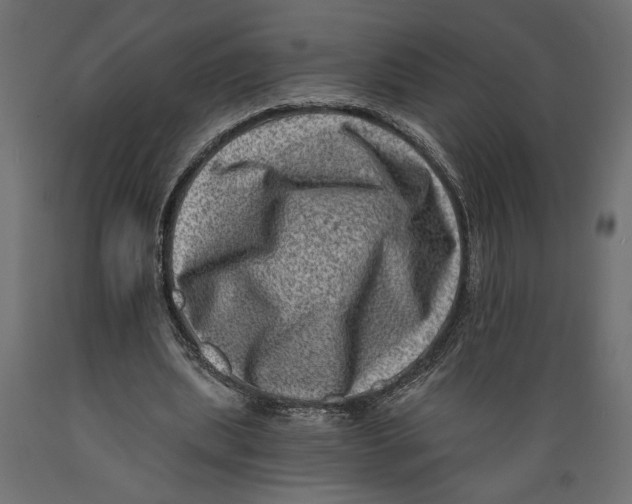 X0000088890439200707061435
