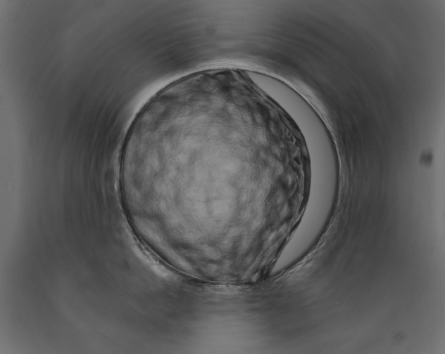 X0000088890862200707061430