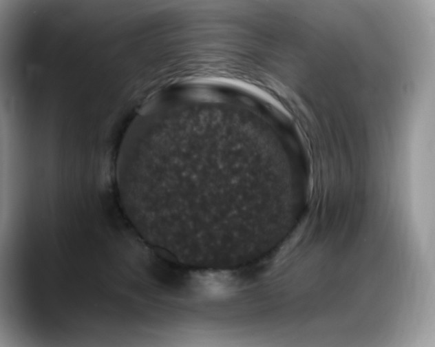 X0000088920517200706081401