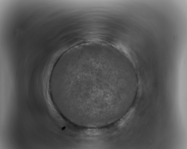 X0000088920145200706151931