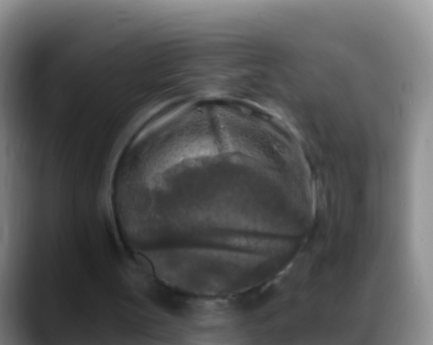 X0000088920147200706151931