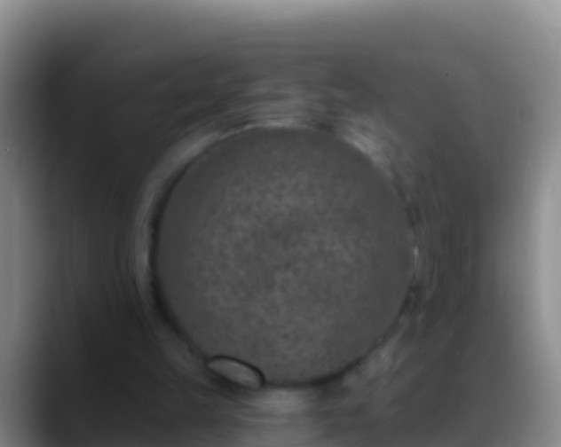 X0000088920149200706151931