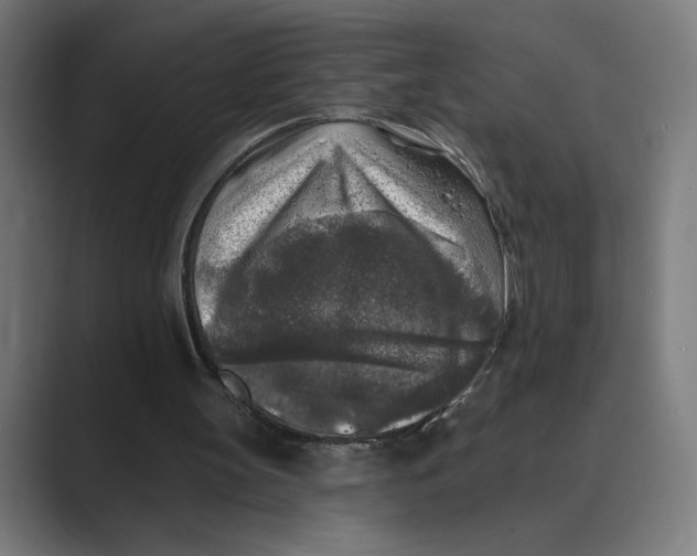 X0000088920147200706291533