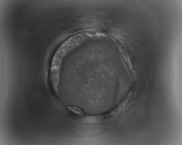 X0000088920149200706291533