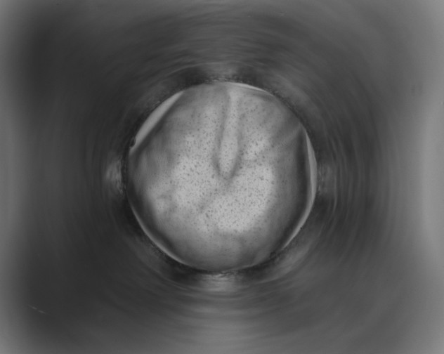 X0000088920238200706291533