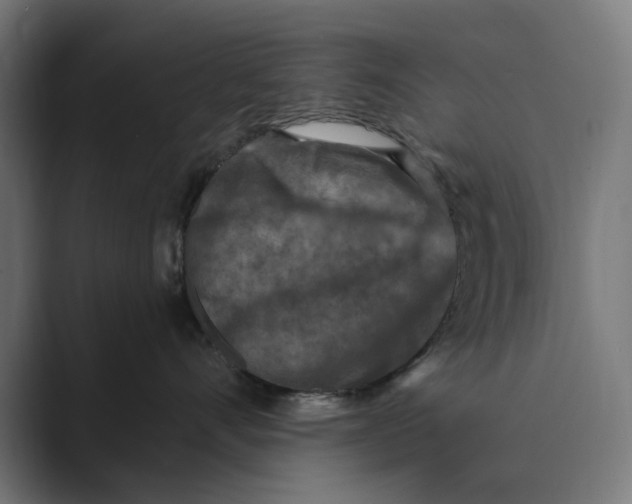 X0000088920528200706291529