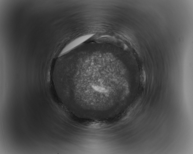 X0000088920504200707061406
