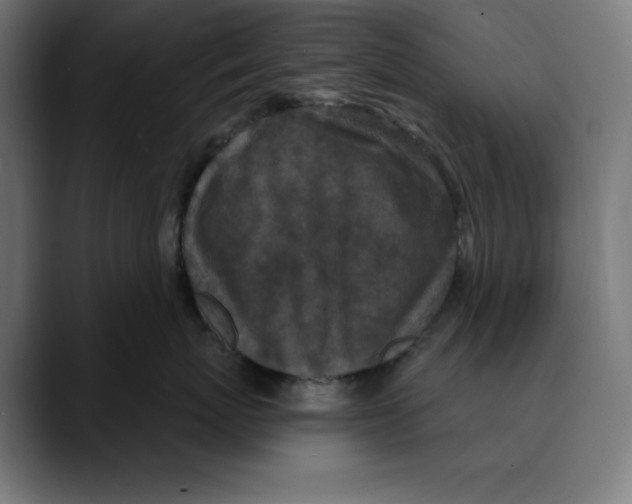 X0000088920767200707061403