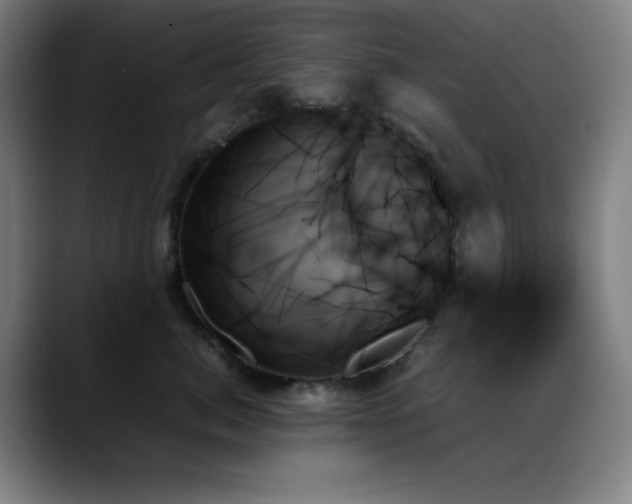 X0000089350764200706151101