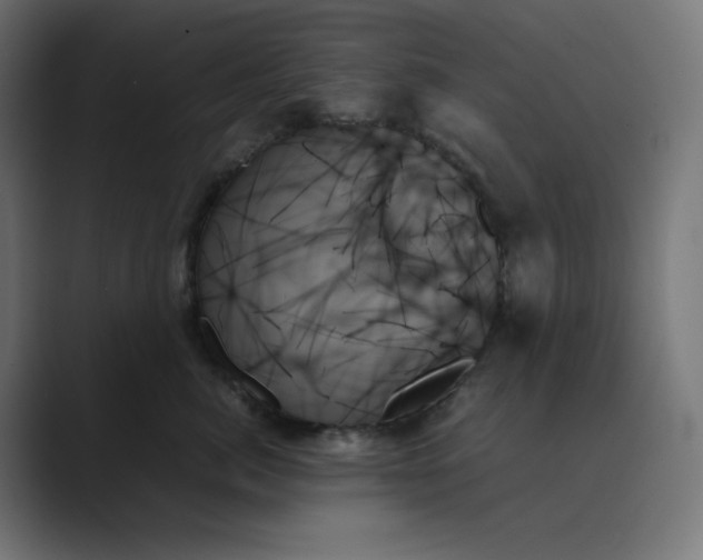 X0000089350764200706291021