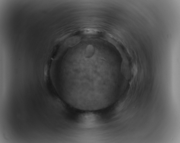 X0000089380219200706151210