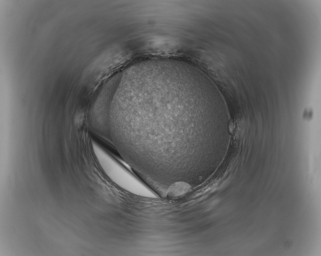 X0000089381202200706221246