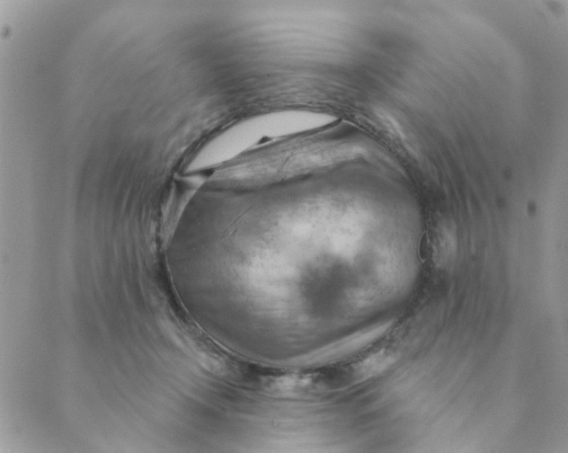 X0000089380366200707061145