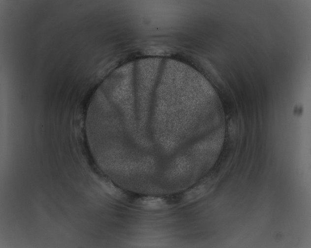 X0000089440322200707131911